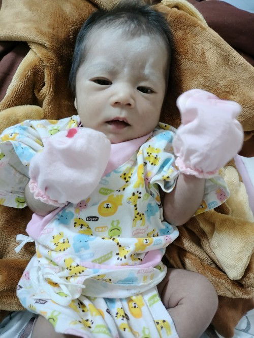 ผ่าคลอดมา16วัน