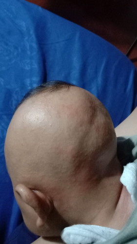 Ini namnya apa ya bun...gimna cara mengatasinya