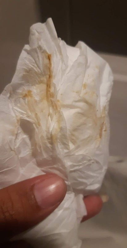 แบบนี้คือใกล้คลอดหรือยังคะ (ท้องแรก)