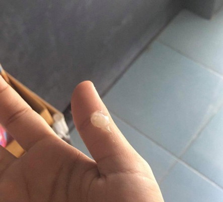 มูกใสใช้ไหมค่ะแบบนี้