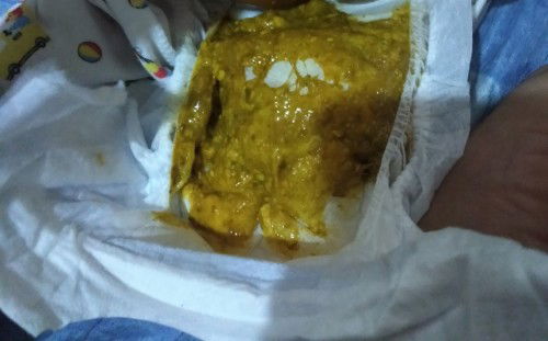 Normal poop Po ba ito.