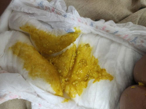 POOPING - 4 MONTHS OLD BABY GIRL