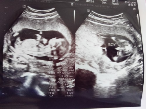 ช่วยดูเพศลูกหน่อยค่ะ