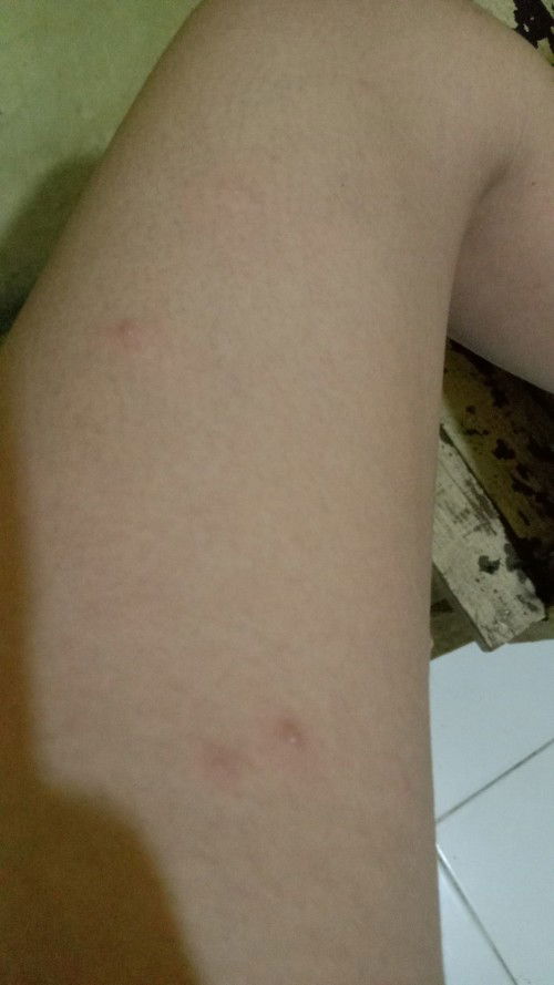 Usia kandungan 30wek 4day,,,