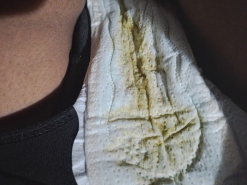 กังวลใจมากๆเลยค่ะ