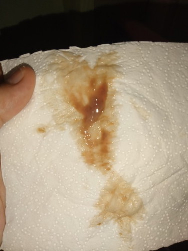 Mucus plug na kaya ito?