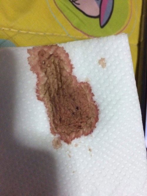 ขออนุญาตสอบถามครับ ใช่สีเลือดล้างหน้าเด็กมั้ยครับ แต่มีนิดเดียวนะครับ ไม่เยอะเหมือนประจำเดือนครับ ขอ