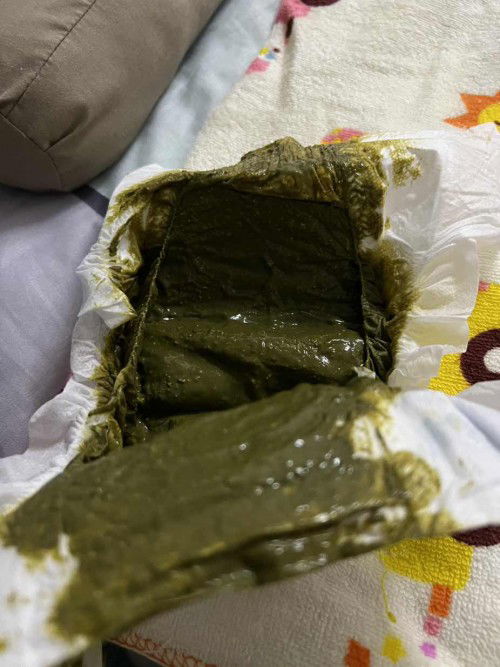 Normal ke najis bayi warna hijau pekat mcmni untuk bayi yg minum susu formula?