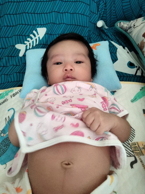 สะดือเด็ก2เดือน