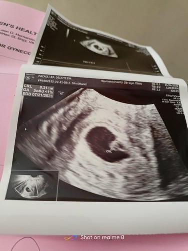 May heartbeat na po ba ang baby kapag 5weeks and 6 days palang po? Pasagot po salamat po ng marami..
