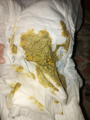 Normal Poop?