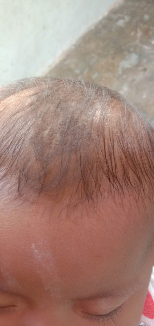 Bagi pengetahuan nya bunda
Usia 3 bulan 15 hri
Ada kotoran sperti di gambar di bagian ubun²