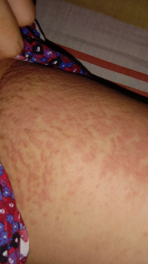 hamil tua. ada yang tau inii kenapa ya bunda.:((((