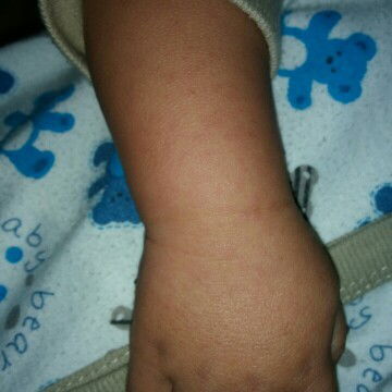 Itu kenapa ya bun bintik bintik merah,  anak aku umur 6 bulan 11 hari