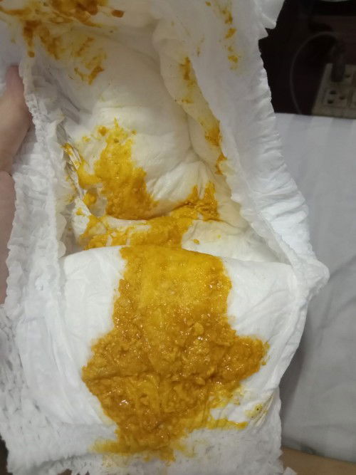 สอบถามหน่อยค่ะแม่ๆ