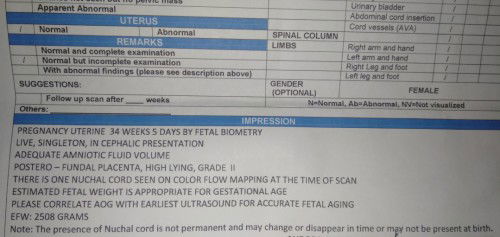 Ask lng po for midwife/obgyne here, Ano po ba result ng ultrasound ko? Normal po ba?Salamat sa sgot
