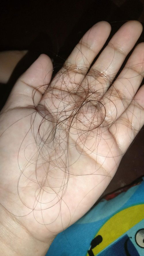 hair fall