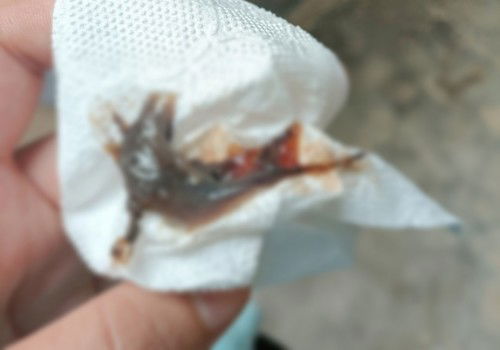 มีมูกสีน้ำตาลเหมือนปจด.ใกล้จะหมด