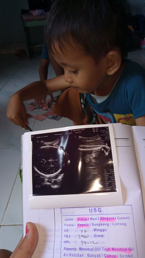 36 weeks udah masuk panggul