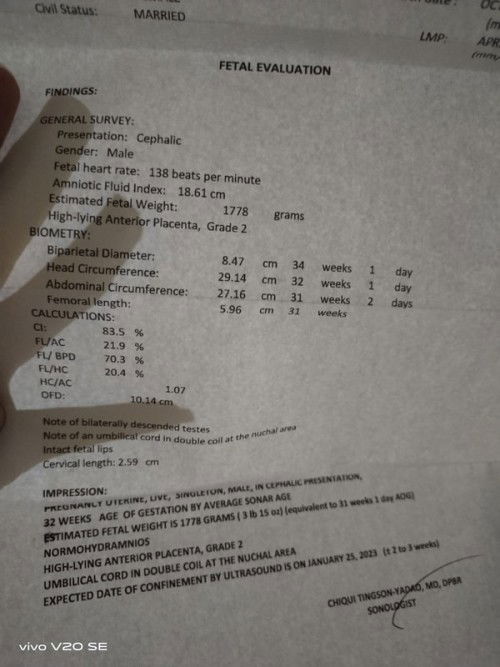 Last week UTZ vs. After 1 week UTZ