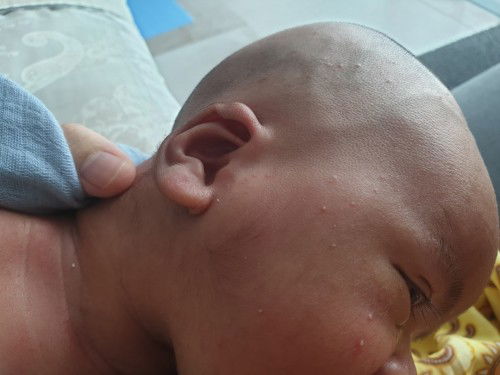 kulit baby bintik2 merah