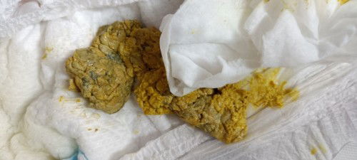 Kulay ng poop 2 months old