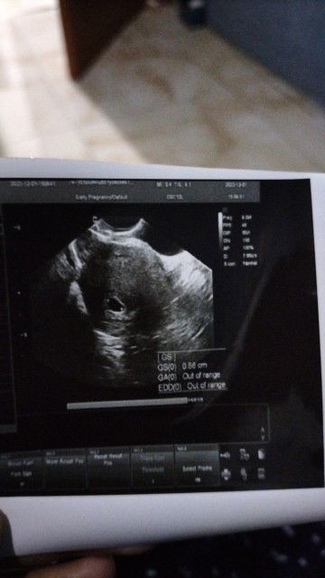 Nanya dong bunda bunda..