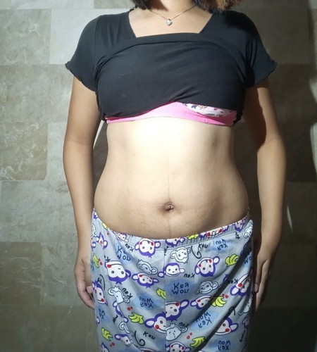 Pregnancy Belly fat