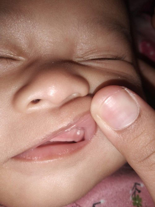 Bun ada yg sama ga yah