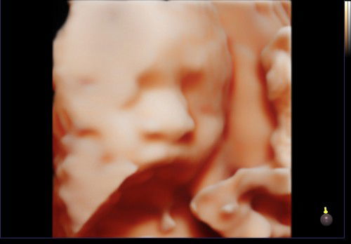 ช่วยคิด เเละ ตั้งชื่อเล่นลูกชาย หน่อยค่ะ😊