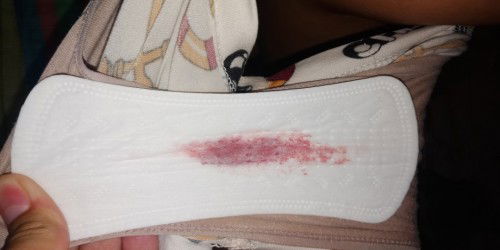 Spotting @38weeks and 1 day