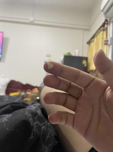 มูกใส 37+5 แบบนี้ปกติไหมคะแม่ๆ