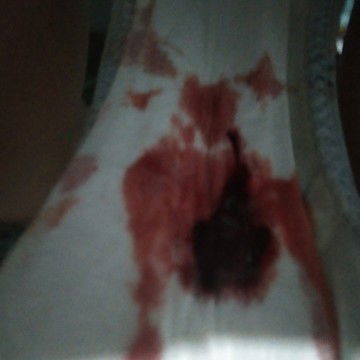 37weeks &6days pregnant