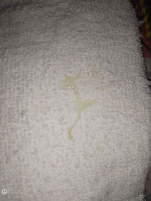 Tanong kulang po mga my , MUCUS PLUG po ba to ? Paki sagot Naman po salamat 🙏