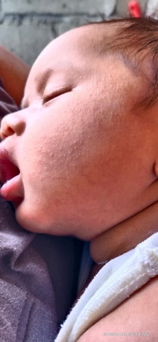 May butol butol ba ang face ng baby n'yo?