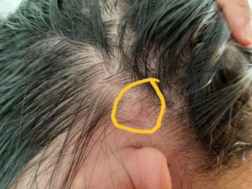 Tigyawat sa ulo ba ito? Help please.