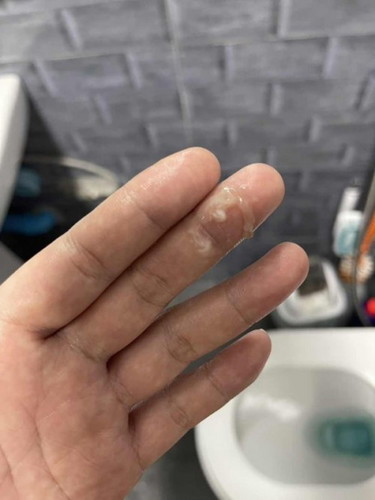 มีมูกใสออกมาจากช่องคลอด วันนี้ต้องไปโรงโรงบาลไหมค่ะ ต้องนี้ 39w + 1 ค่ะ
