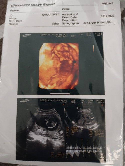 USG 4D HPL 9 Juni 2023