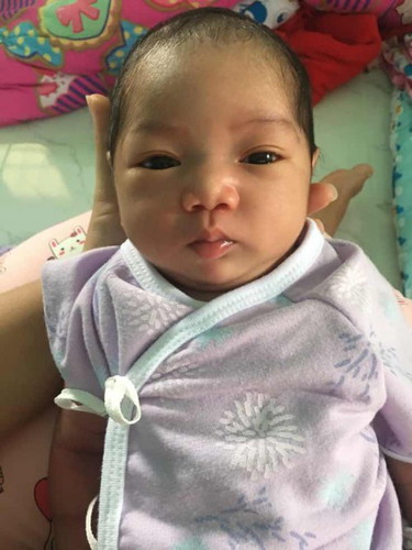 ลูกได้ 17 วัน กินนมแม่กับนมชง s 26 สีทอง แล้วไม่อึ ปกติมั้ยค่ะ แต่น้องตดบ่อย แต่ถ้าวันนั้ยอึน้องจะเบ่งอึจนหน้าแดงเลยค่ะแต่อึไม่แข็ง