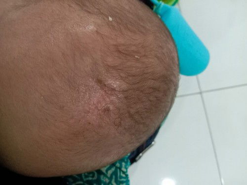 Gatau itu kenapa apa ada yang tau?