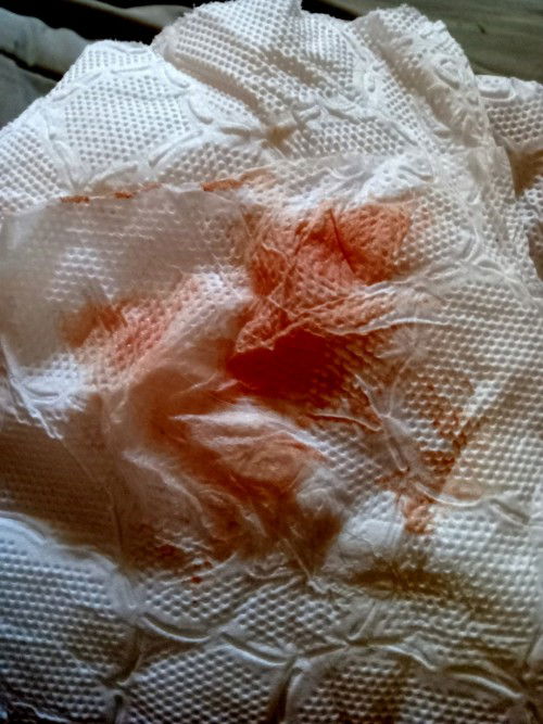 มีเลือดออก