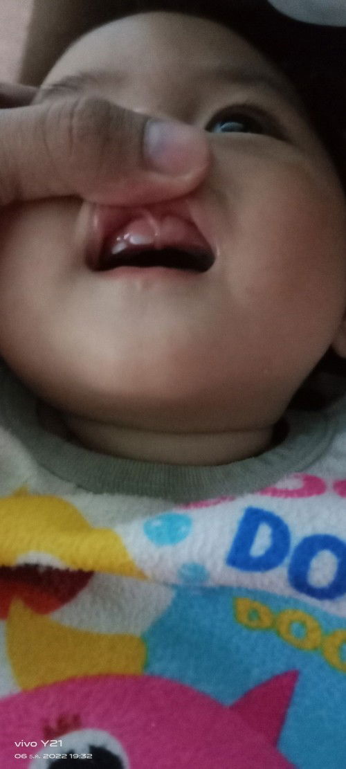 ดอกไม้(ฟัน)