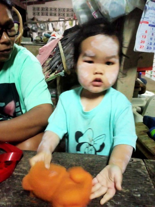 น้องหน้าบวม