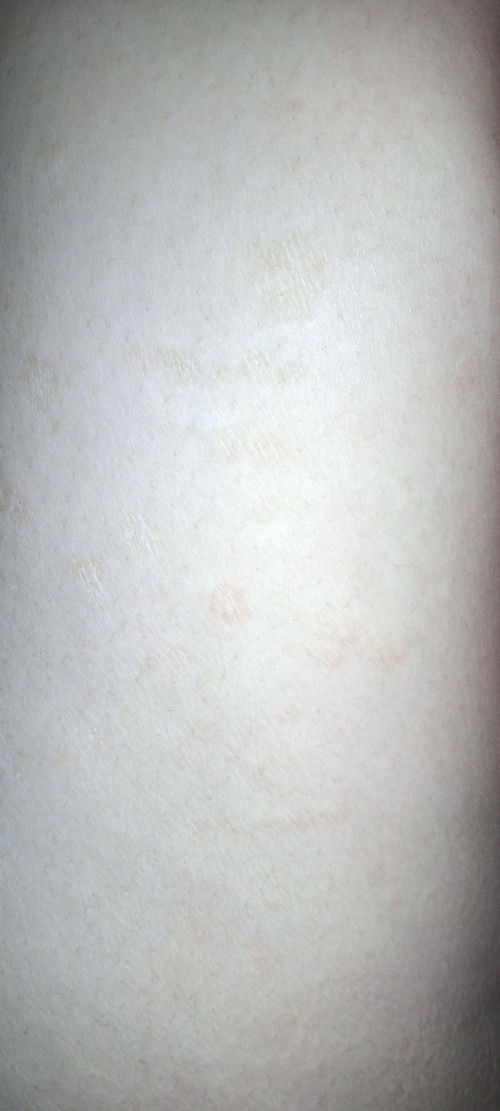 Kulit
Halo bun mau tanya ini kulit kira kira kenapa ya, semenjak hamil jadi muncul kulit seperti itu