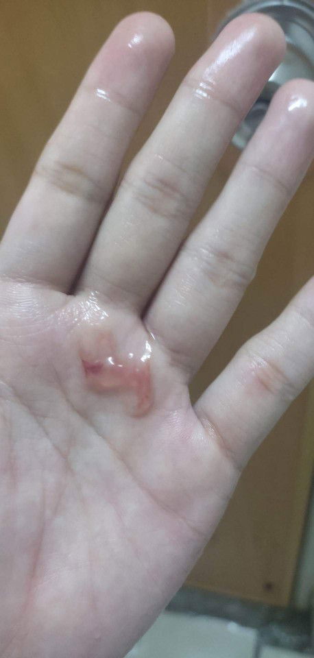 Mucus plug or sign na nag lalabor na?