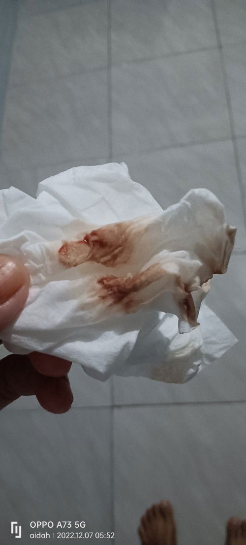 Ngeflek diusia 7 minggu