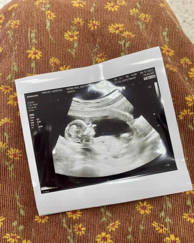 คุณแม่ช่วยๆดูหน่อยค่าา ว่าได้ลูกสาวหรือลูกชายคะ