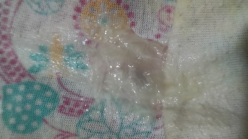 Pasintabi po, mucus plug na po ba ito? 38weeks tomorrow 1cm na din.