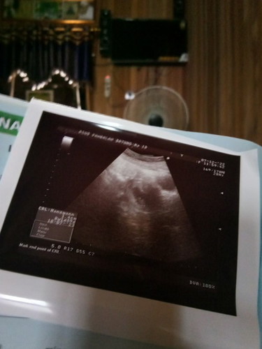 hpht 30septmbr..kira2 baru 9 mnggu..di usg belum ada detak jntung nya..sedihnya..