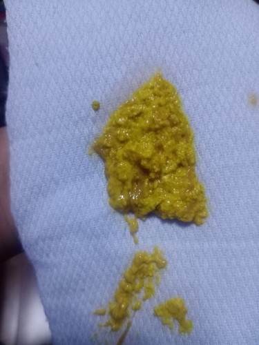 Baby Poop
FormulaFeed